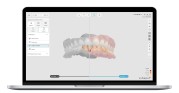 FDA批准3Shape Dx软件用于牙科诊断