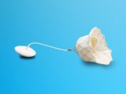 雅培的Tendyne二尖瓣置换植入物获得美国批准