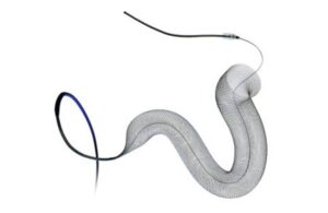 美敦力Pipeline Vantage栓塞装置 美敦力Pipeline Vantage栓塞装置