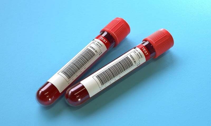 blood test tube