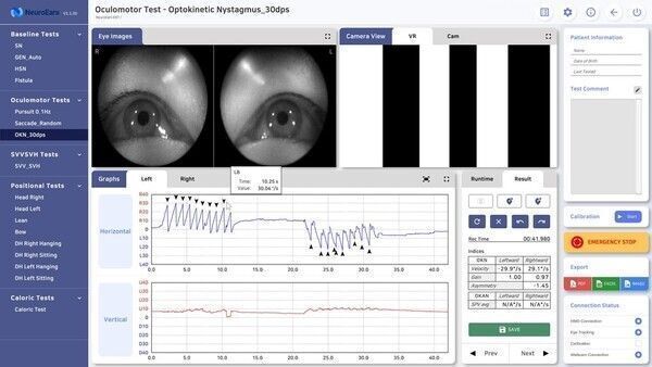 NeuroEars Anna’s software screen (Courtesy of Hallym University Medical Center)